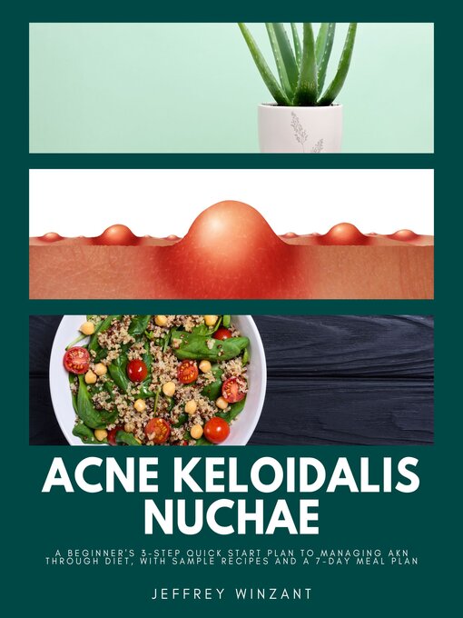 Title details for Acne Keloidalis Nuchae by Jeffrey Winzant - Wait list